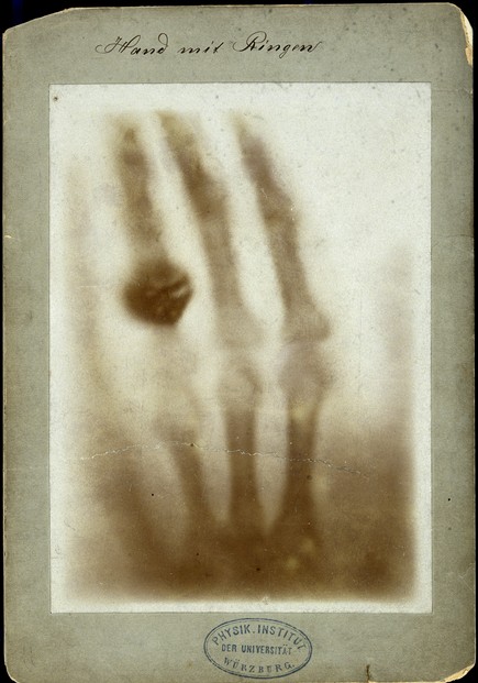 First radiograph